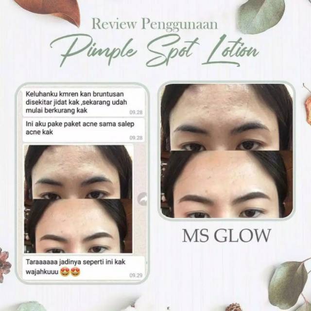 12 Cara Menghilangkan Bruntusan Secara Alami & Produk Lokal 12 Cara Menghilangkan Bruntusan Secara Alami & Produk Lokal
