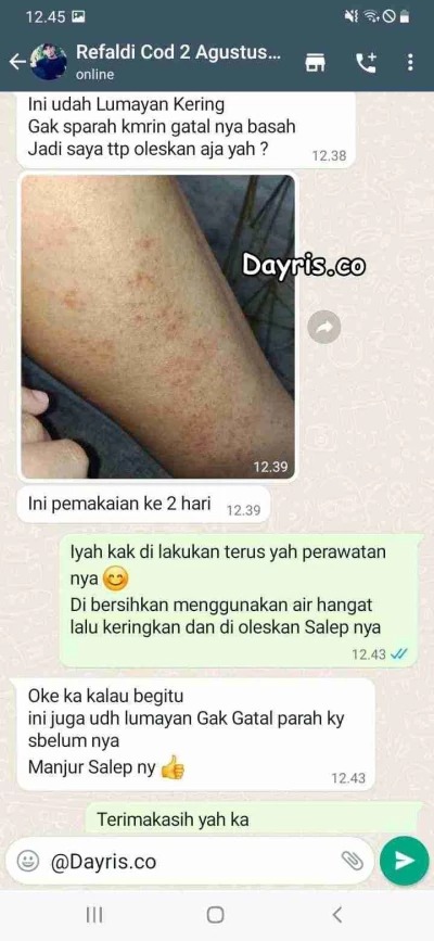 -