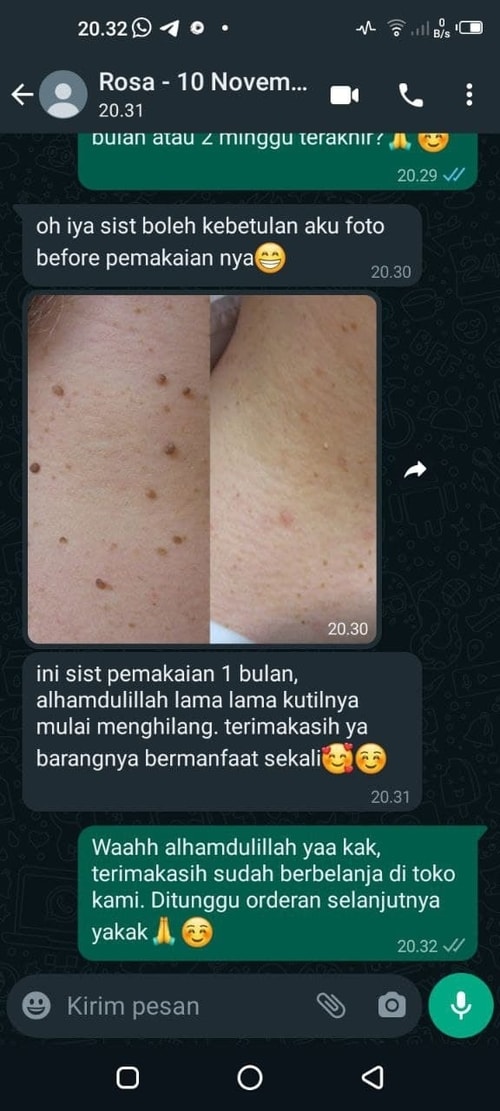 -
