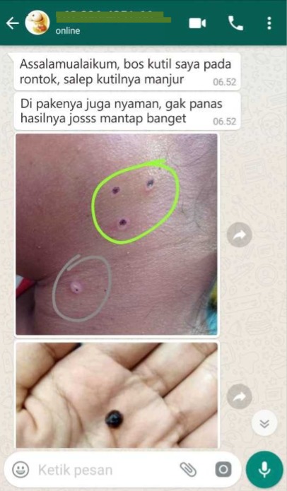 -