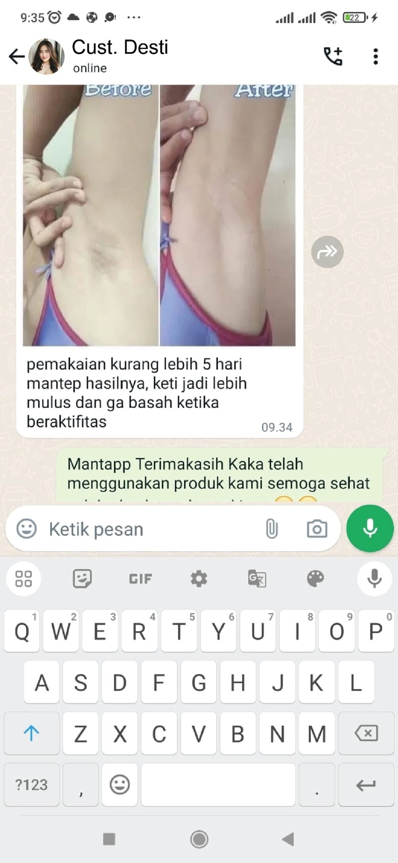 -