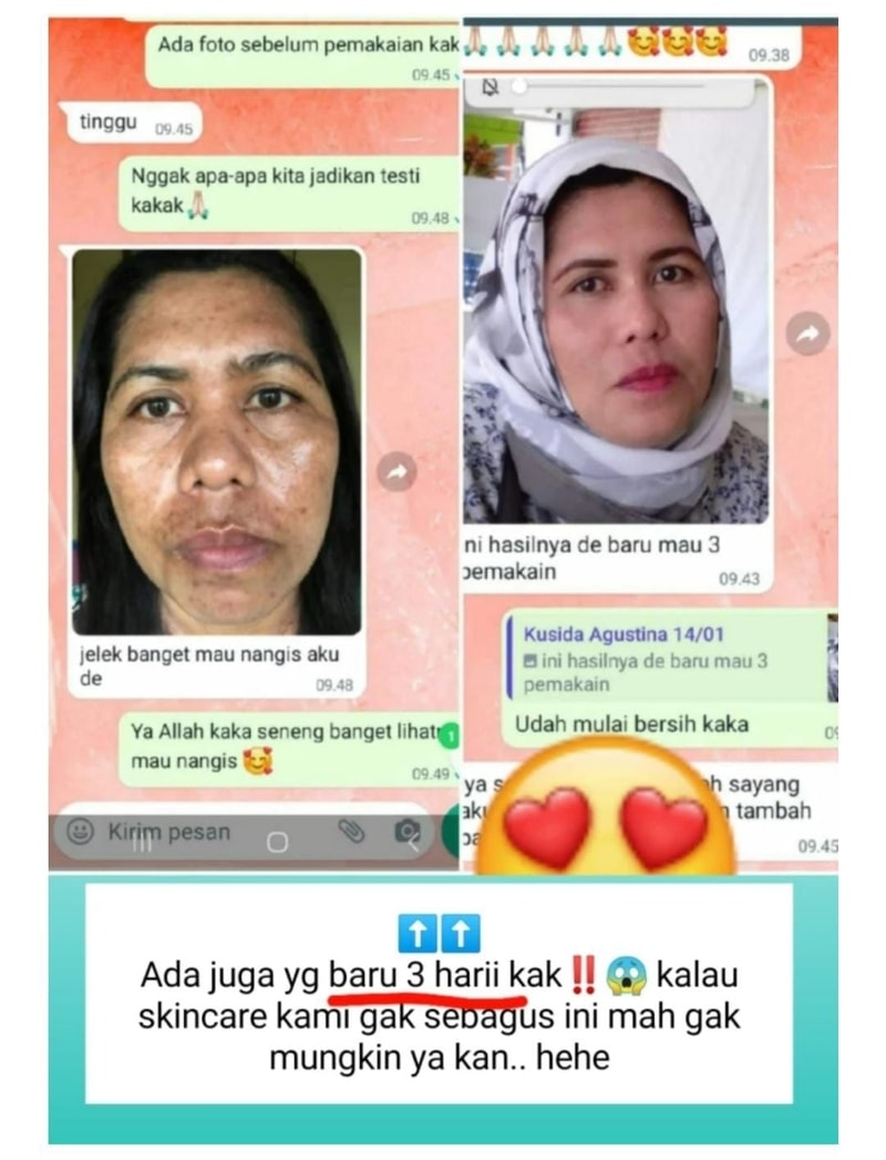 -