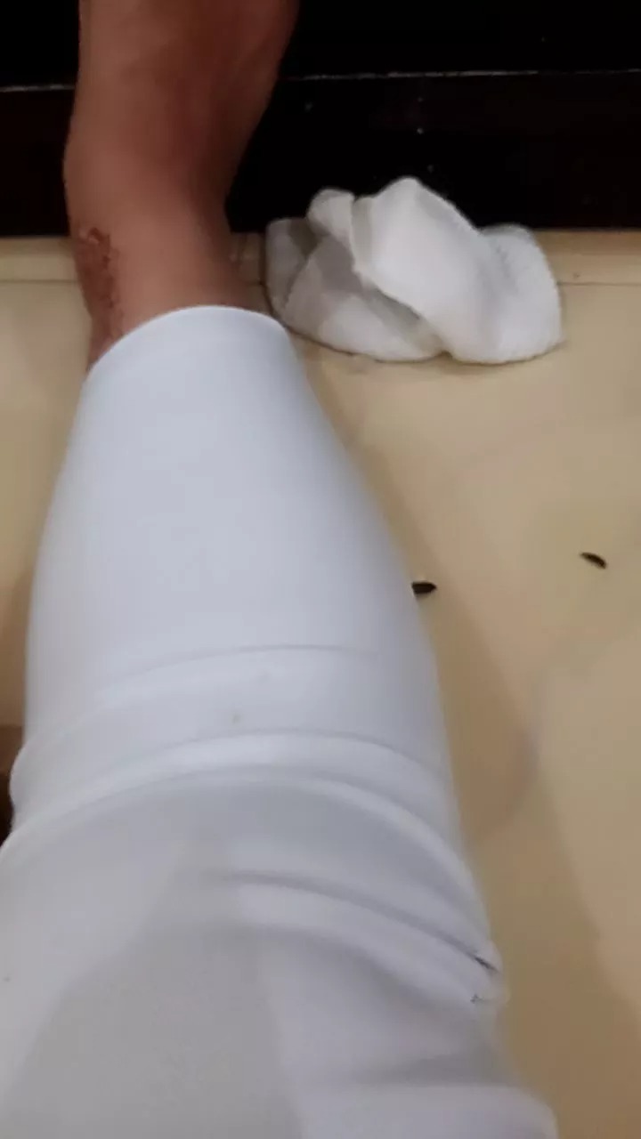 -