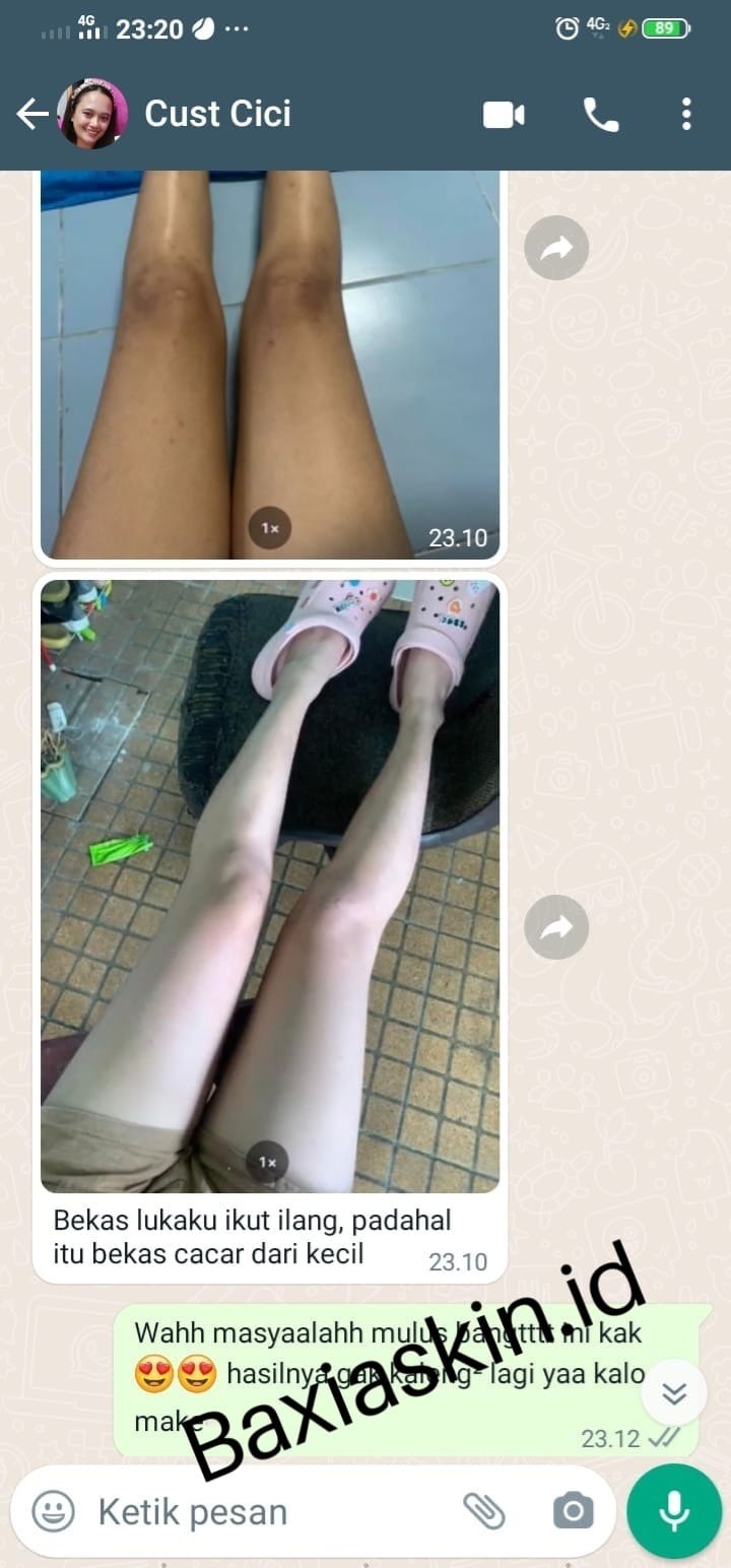 -