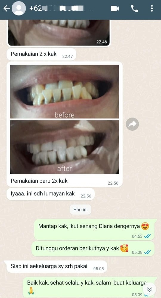 -