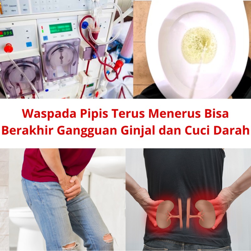 -