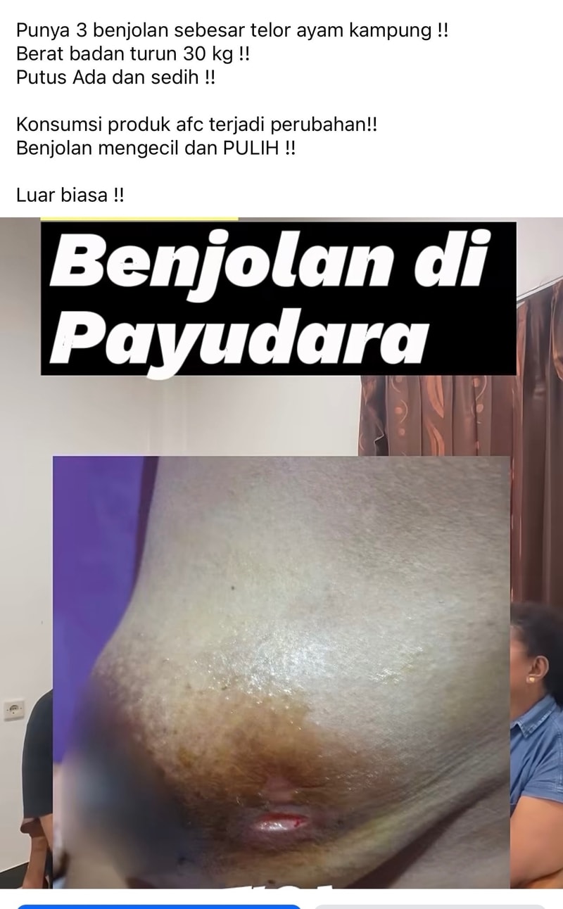 -